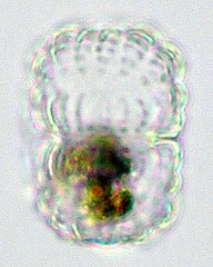 Cosmarium crenatoides